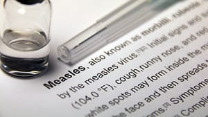 measles outbroke chicago